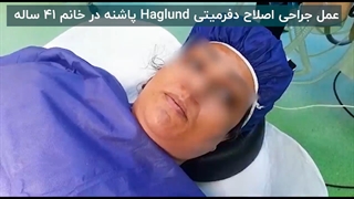 عمل اصلاح دفرمیتی پاشنه پا در خانم 41 ساله