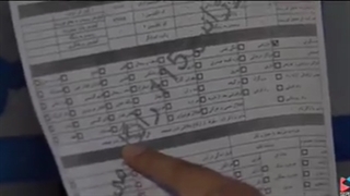 سارینا اسماعیل زاده لیفت گردنایمپلنت دندان