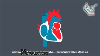 بیماری های مادرزادی قلبی