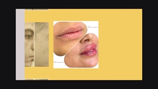 تزریق فیلر و تمامی خدمات پوست و مو در کلینیک تخصصی تهران نوین