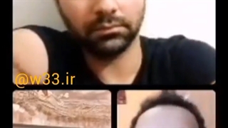لایو پیمان روشن ضمیر با دکتر رزازیان مهر ۱۴۰۰ اتوپلاستی