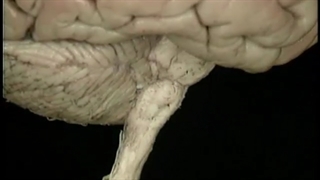 آناتومی سیستم بطنی و ساقه مغز آکلند دوبله فارسی