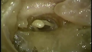 استخوانچه های گوش آکلند دوبله فارسی