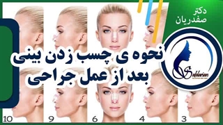 فیلم نحوه ی صحیح چسب زدن بینی بعد از عمل