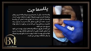 پلاسما جت چیست و چه کاربرد و فوائدی دارد؟ اصلاح فرم صورت