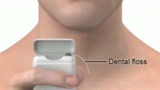 استفاده از نخ دندان