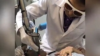 کلاژن سازی پوست چجوری هست؟