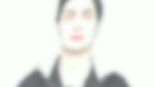 نمونه کار جراحی بینی