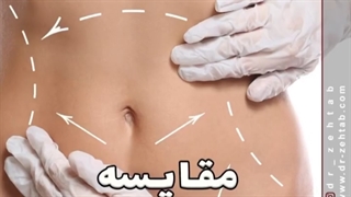 روش های لاغری