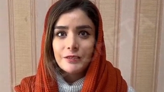 ❌❌چانه نقش مهمی در زیبایی صورت دارد.