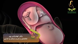 زایمان طبیعی