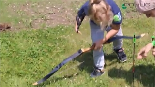 پروتز زیبایی