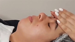 فیشیال صورت هایفوتراپی