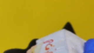 لیمنت-سرامیکی-دندان-در-اصفهان-دکتر-مهدی-کچویی-دکتر-راضیه-کامران