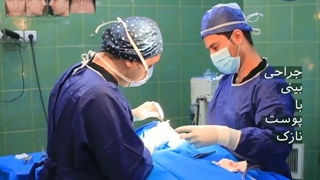 پوست بینی شما نازکه ؟