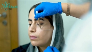 زاویه سازی صورت برای زیباچوی عزیزمون