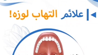 علائم التهاب لوزه