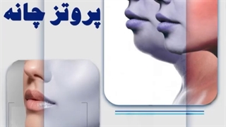 پروتز چانه