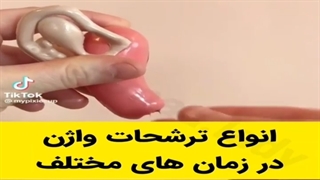 انواع ترشحات واژن