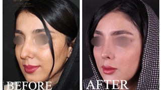 جراحی بینی مراجعه کننده ی عزیز