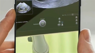 حرکت جنین کوچولو رو 