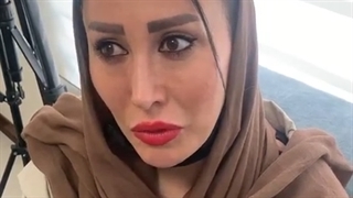 رضایت مراجعه کننده عزیزمون بعد از دوسال