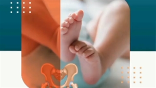 در رفتگی مادرزادی لگن