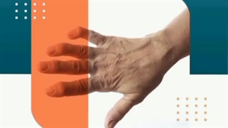 نشانه های آرتریت عفونی چیه؟