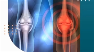 تفاوت تعویض مفصل