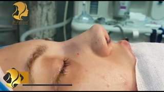 فیلم واقعی جراحی بینی