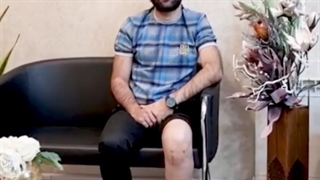 ⭕چهارده روز بعد از عمل جراحی رباط صلیبی ⭕ جوان فوتبالیست 