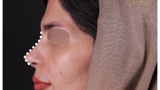 بینی به این قشنگی دیده بودین؟
