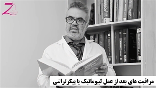 مراقبت بعد از لیپوماتیک