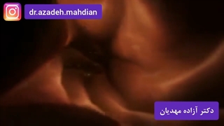 فیلم ivf