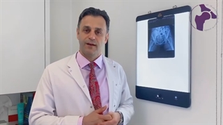 عویض مفصل در بیماران روماتیسمی