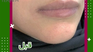 نمونه لب روسی