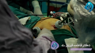 عمل جراحی هیسترکتومی