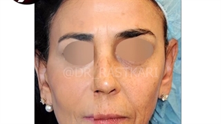 چجوری جوان تر بشم؟