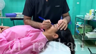جراحی پلک در اتاق عمل