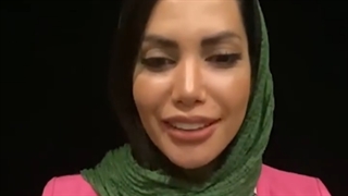 جراحی ترمیم بینی بعد از 6 ماه