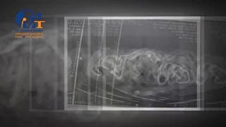 فیلم جراحی تعویض مفصل لگن و رضایت بیمار