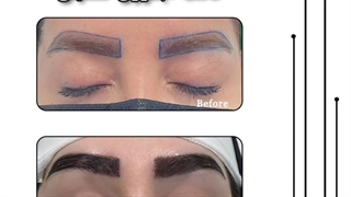 کاشت ابرو دخترونه
