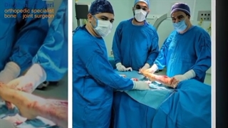 فیلم درمان بیماری بورسیت آرنج