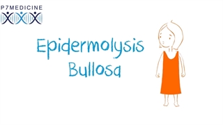 تشخیص بیماری پروانه ای یا (ایپدرمولیزبولوزا)