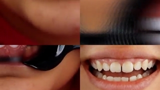 سبحان دنتال . کامپوزیت