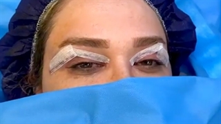 دیگه وقتشه با افتادگی پلک هات خداحافظی کنی