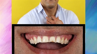 لبخند زیبا حق شماست و آفرینش یک لبخند تخصص ماست -دندانپزشکی عرشیان