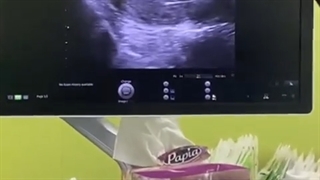 همیشه یه راهی برای بچه دار شدن هست. به امید برآورده شدن آرزوی همه زنان سرزمینم