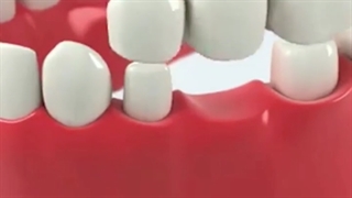 دندون هاتو اردتودنسی کن