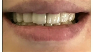 لبخند زیبا داشته باش